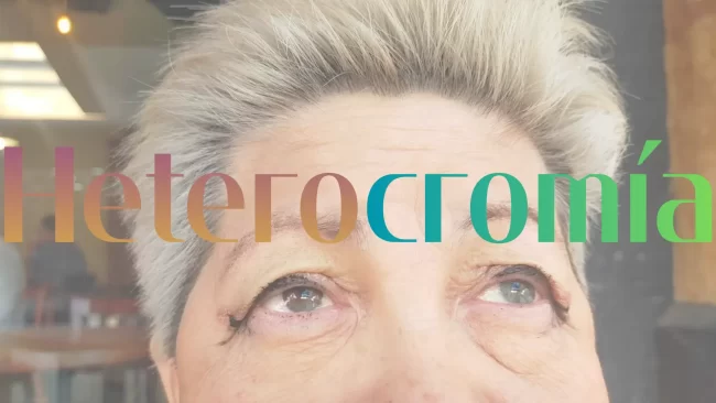 Heterocromia.webp